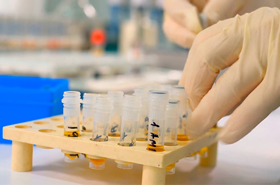 Ir a la noticia La COVID-19 obliga a incrementar los esfuerzos para luchar contra la “epidemia” de los residuos plásticos